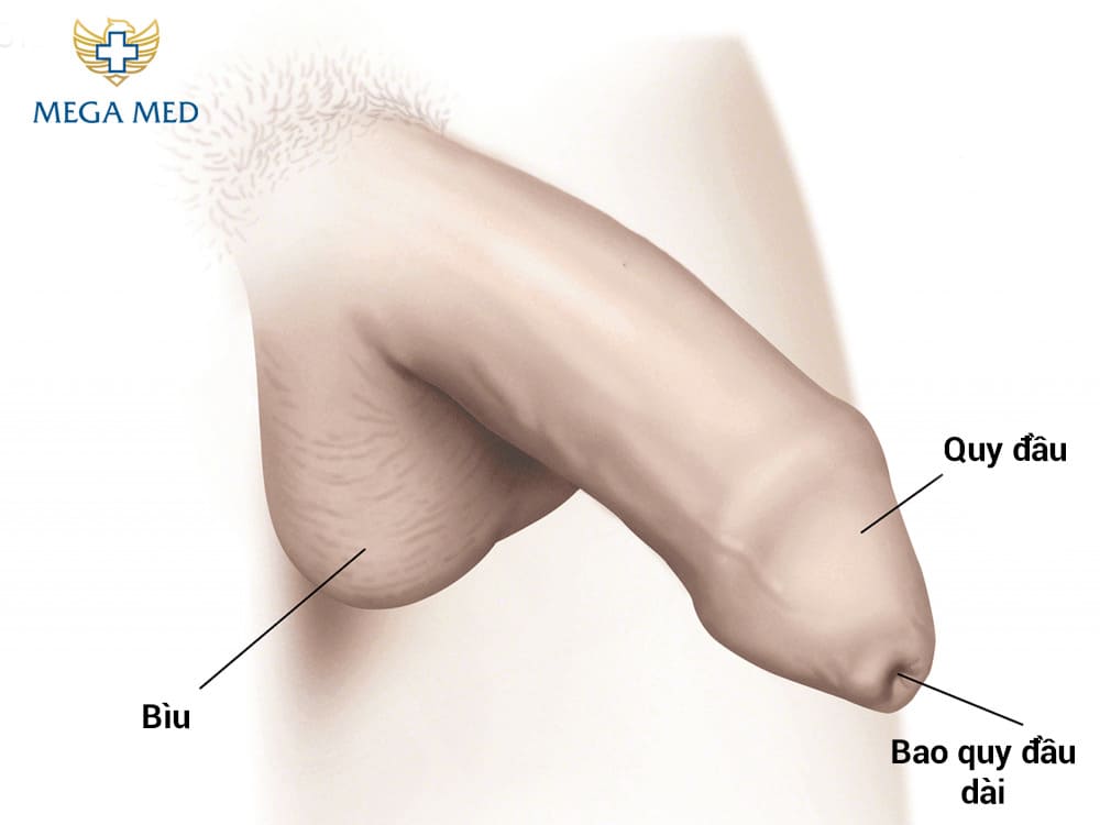 Nếu phụ huynh phát hiện bao quy đầu của trẻ có những dấu hiệu bệnh lý cần đưa trẻ đến gặp bác sĩ